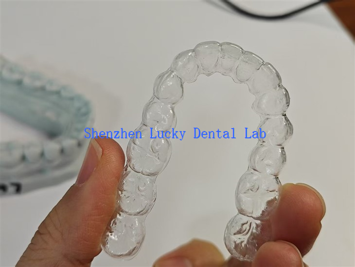 Clear Retainer Without Braces